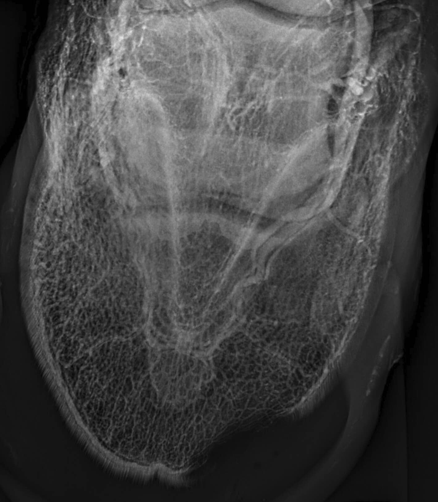 Case Study Uses Digital Venography To Identify Hard-To-Find Hoof ...