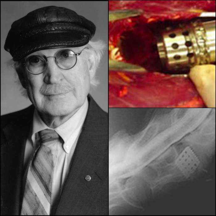 Dr. Bagby, Inventor Of 'Seattle Slew Basket,' Dies Paulick Report Shining Light on