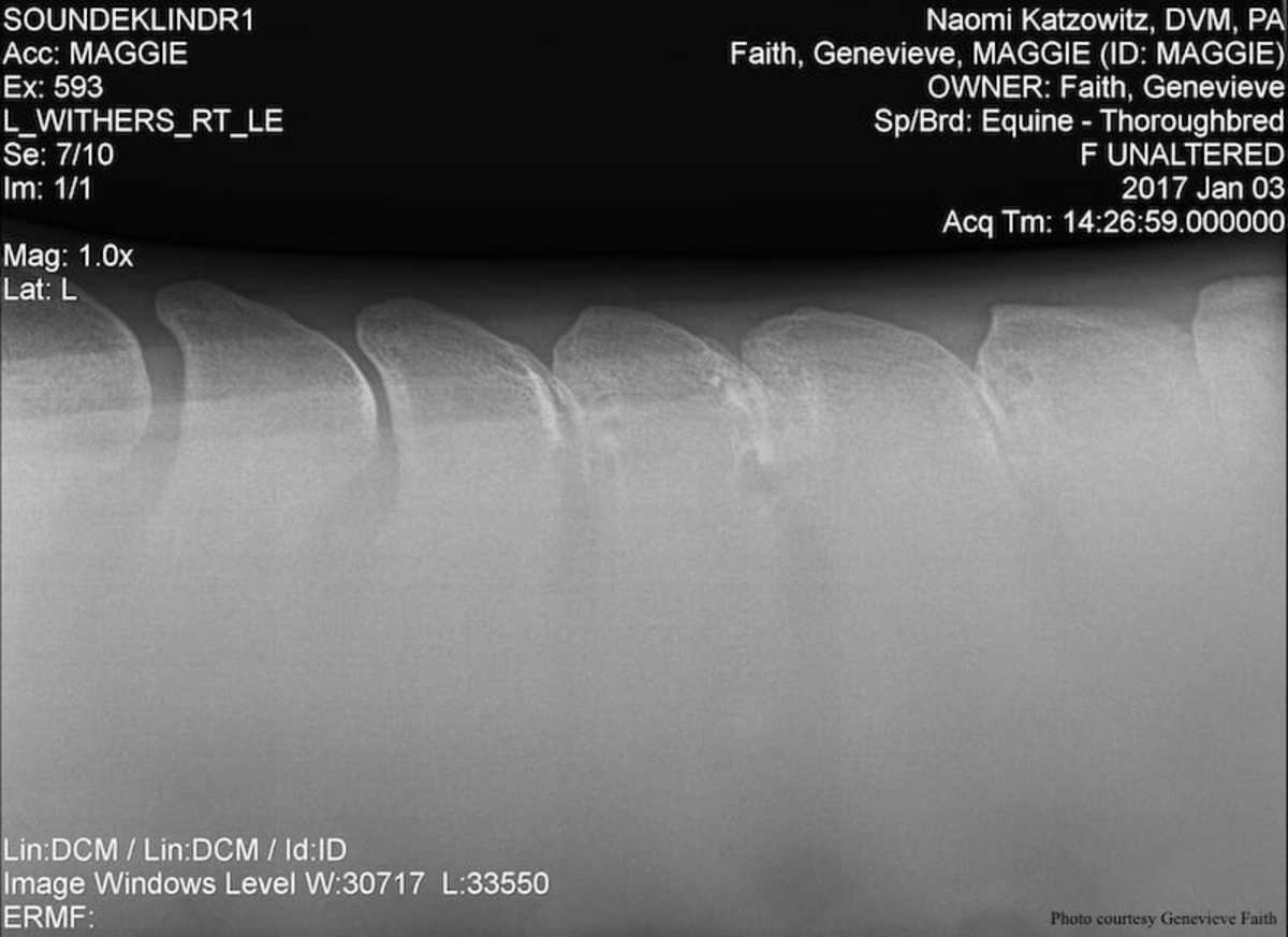 This radiograph shows an example of kissing spines in another horse