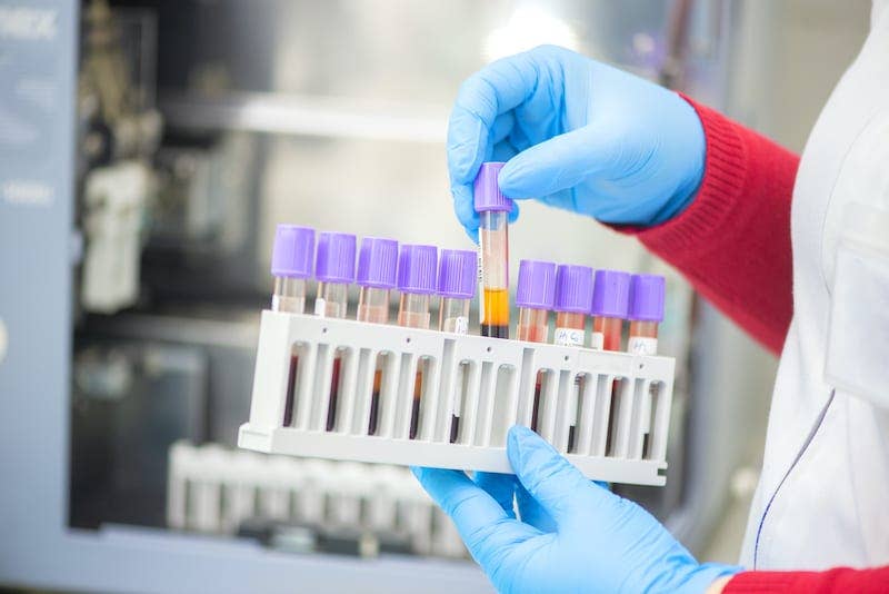 The Drug Testing Back Story That Led To Louisiana's Zilpaterol Positives – And Hope For The Future - Horse Racing News - Vimarsana News